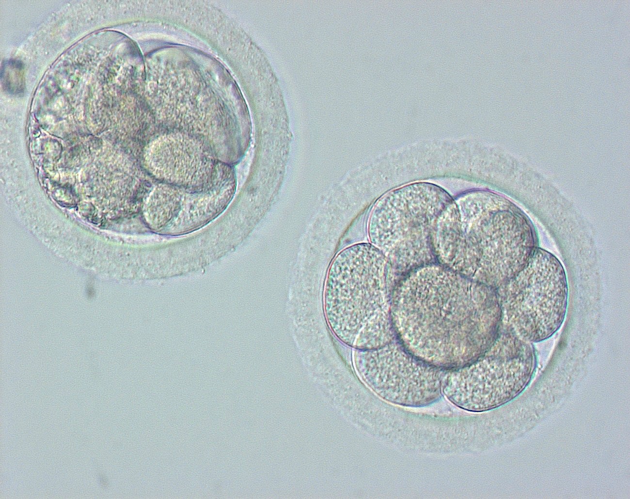 Rhesus monkey embryos resulting from intracytoplasmic sperm injection